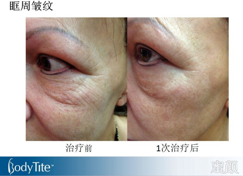 https://img.miyanlife.com/mnt/timg/180131/1145044630-7.jpg