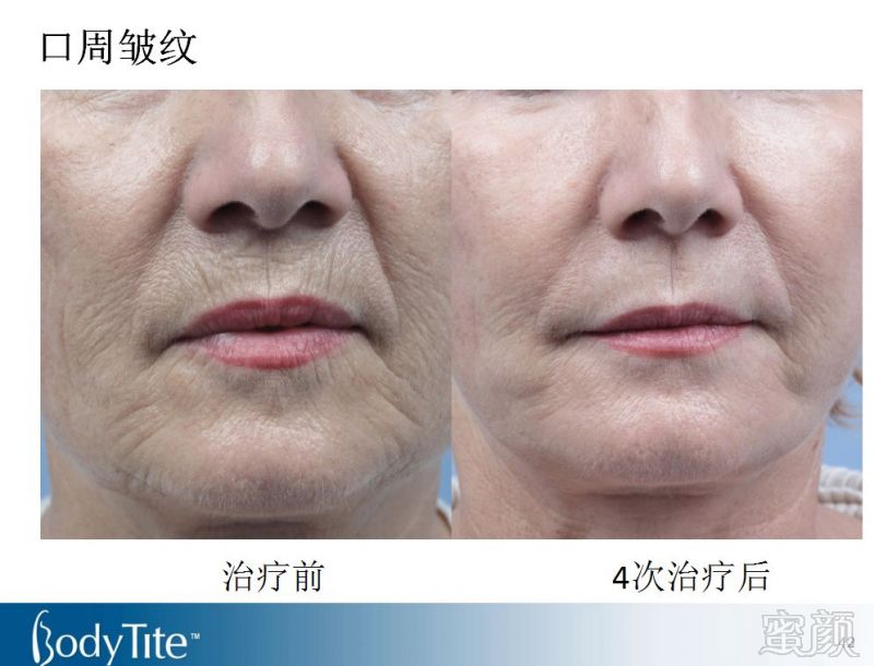 https://img.miyanlife.com/mnt/timg/180131/1145052931-9.jpg