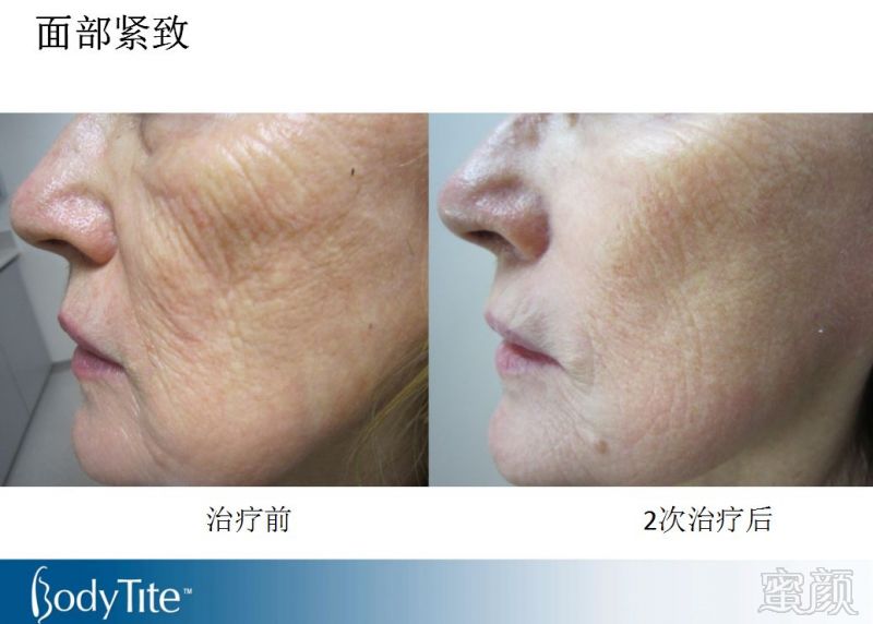 https://img.miyanlife.com/mnt/timg/180131/11450B0T-10.jpg