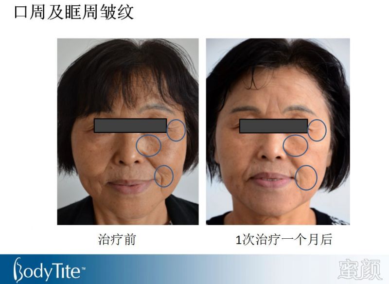 https://img.miyanlife.com/mnt/timg/180131/11450C535-11.jpg