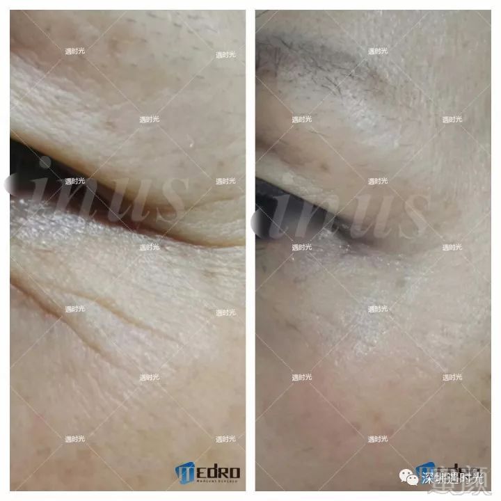 https://img.miyanlife.com/mnt/timg/180131/12053913K-8.jpg