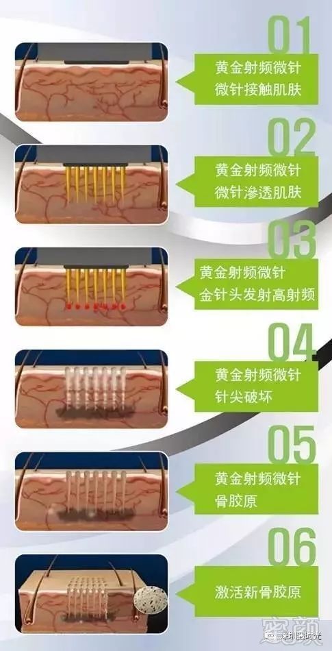 https://img.miyanlife.com/mnt/timg/180131/12053S420-5.jpg