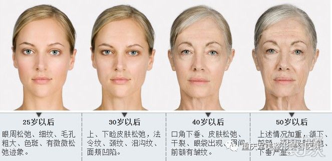 https://img.miyanlife.com/mnt/timg/180131/1224101109-1.jpg
