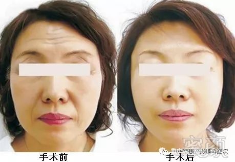 https://img.miyanlife.com/mnt/timg/180131/1224115152-4.jpg