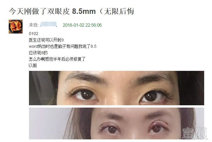 https://img.miyanlife.com/mnt/timg/180131/1224124L7-0.jpg
