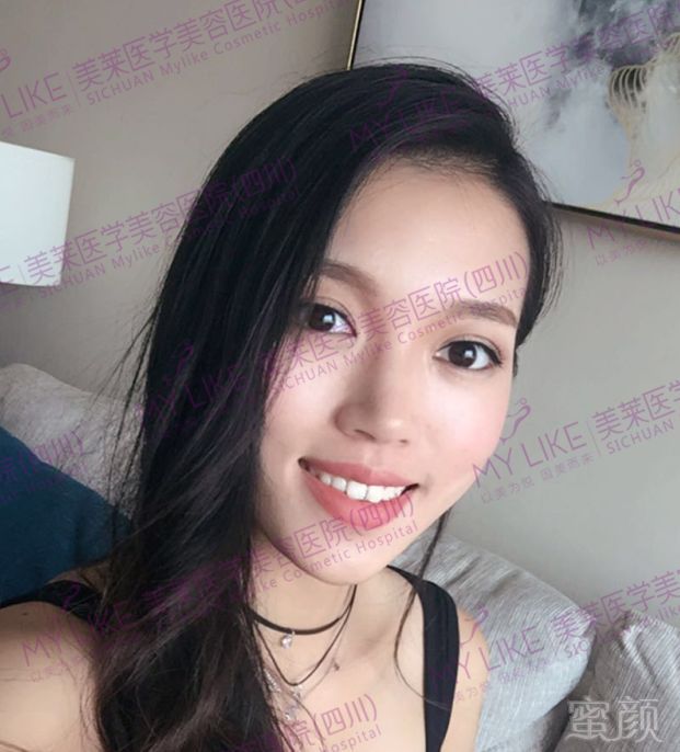 https://img.miyanlife.com/mnt/timg/180131/1224191c6-13.jpg