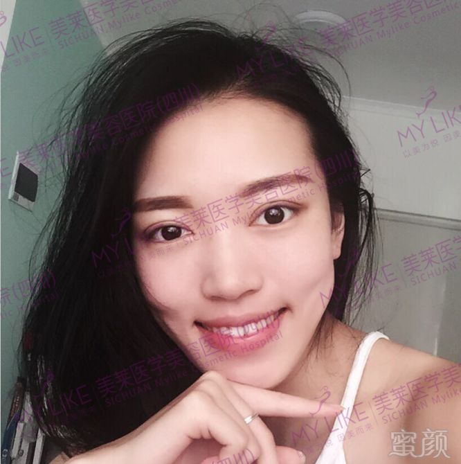 https://img.miyanlife.com/mnt/timg/180131/12241R133-12.jpg