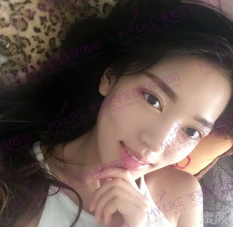 https://img.miyanlife.com/mnt/timg/180131/12241W000-11.jpg