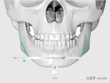 案例图片