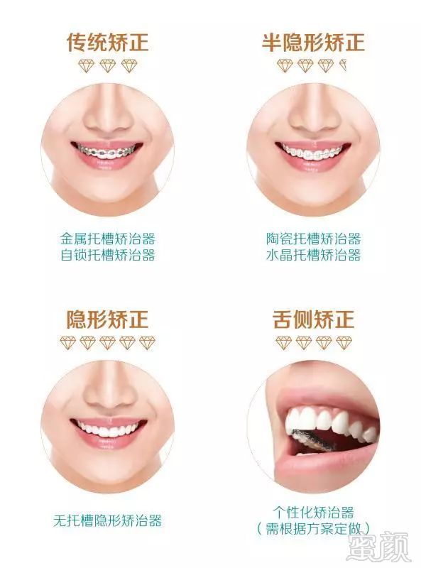 https://img.miyanlife.com/mnt/timg/180131/123R35M9-3.jpg