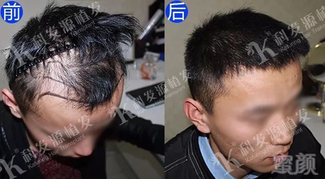 https://img.miyanlife.com/mnt/timg/180131/12513430S-0.jpg