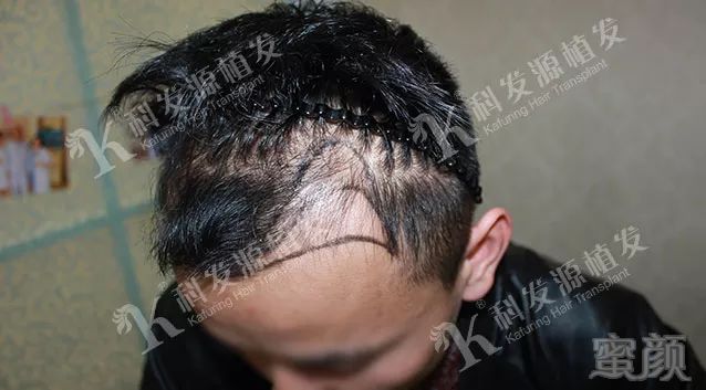 https://img.miyanlife.com/mnt/timg/180131/125134L02-3.jpg