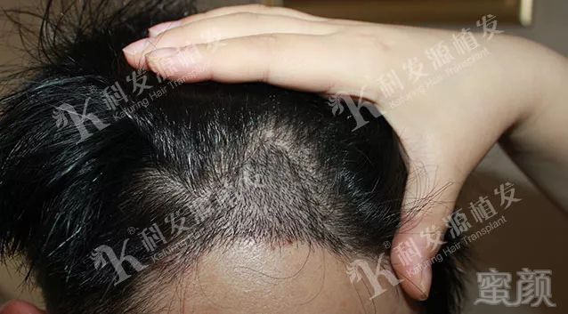 https://img.miyanlife.com/mnt/timg/180131/12513B401-7.jpg