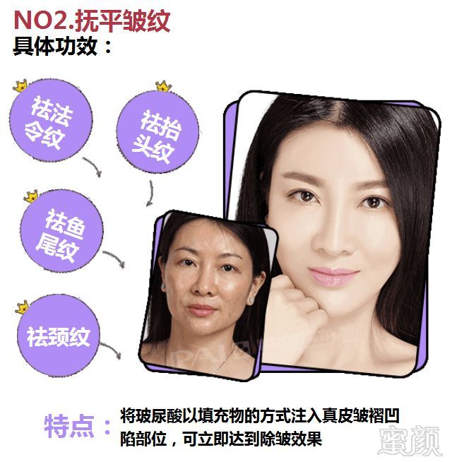 https://img.miyanlife.com/mnt/timg/180131/1300091644-4.jpg