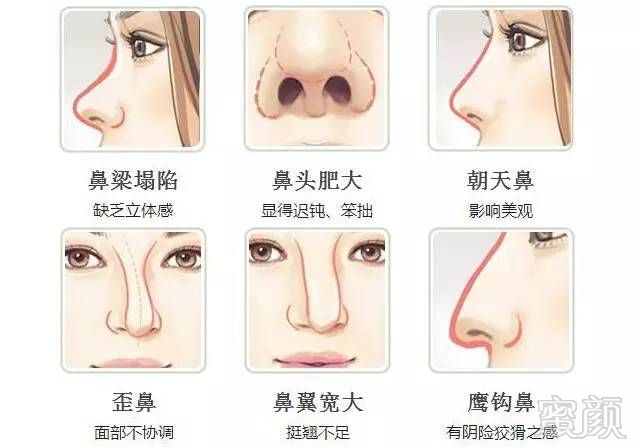 https://img.miyanlife.com/mnt/timg/180131/13004535Z-0.jpg