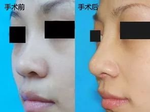 https://img.miyanlife.com/mnt/timg/180131/1300462933-2.jpg