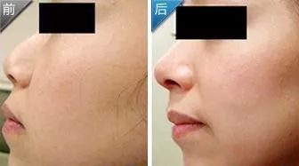 https://img.miyanlife.com/mnt/timg/180131/13004IK2-3.jpg