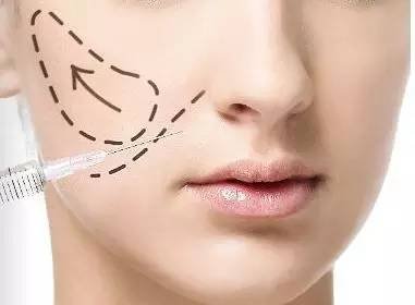 https://img.miyanlife.com/mnt/timg/180201/1155163402-2.jpg