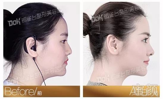 https://img.miyanlife.com/mnt/timg/180201/11551T926-8.jpg