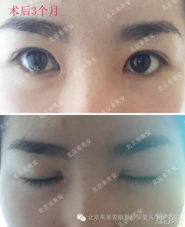 https://img.miyanlife.com/mnt/timg/180201/11555645K-5.jpg