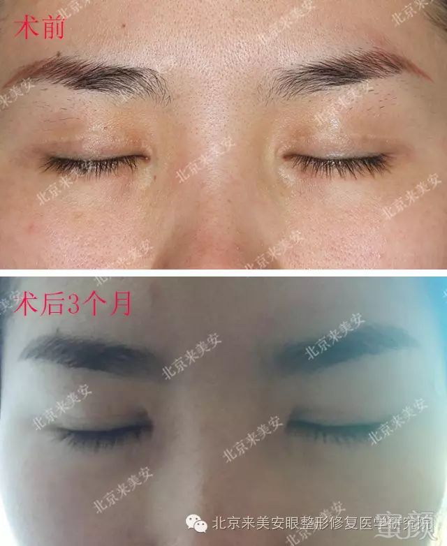 https://img.miyanlife.com/mnt/timg/180201/11555MS4-7.jpg