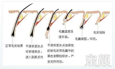 https://img.miyanlife.com/mnt/timg/180201/115I24157-1.jpg