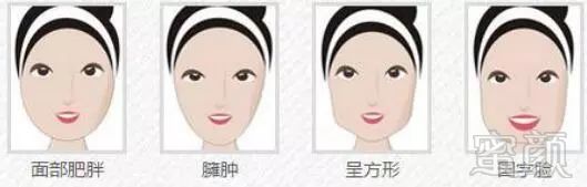 https://img.miyanlife.com/mnt/timg/180201/12115LY8-4.jpg
