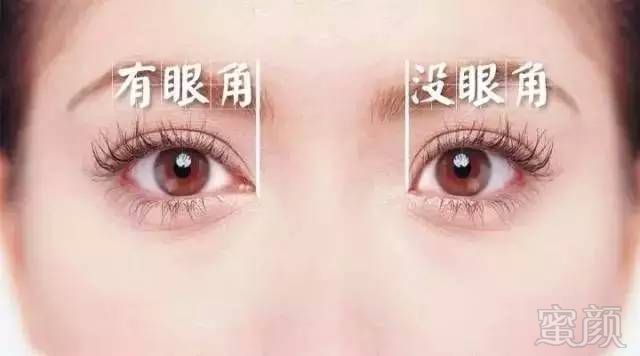 https://img.miyanlife.com/mnt/timg/180201/121T221T-1.jpg