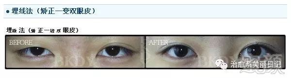 https://img.miyanlife.com/mnt/timg/180201/1302135596-0.jpg