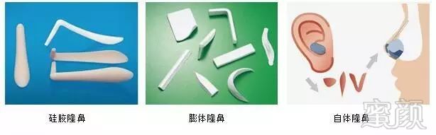 https://img.miyanlife.com/mnt/timg/180201/13122042a-1.jpg