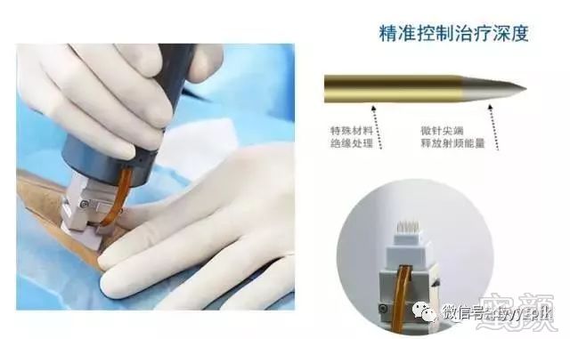 https://img.miyanlife.com/mnt/timg/180201/131250Oa-2.jpg