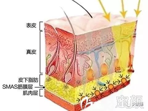 案例图片