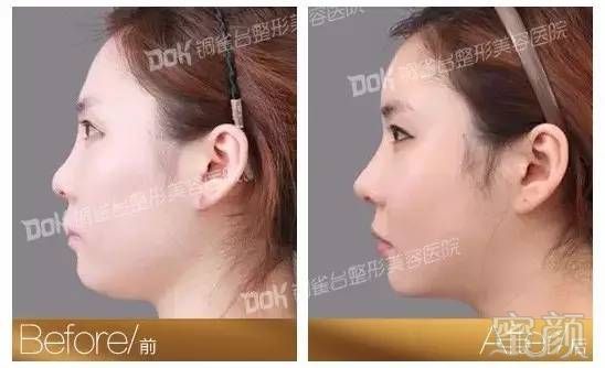 https://img.miyanlife.com/mnt/timg/180201/1315291191-6.jpg