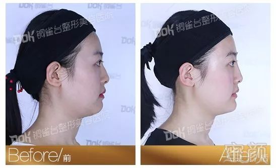 https://img.miyanlife.com/mnt/timg/180201/13152U2c-5.jpg
