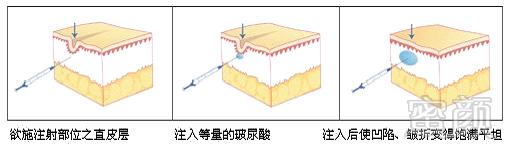 案例图片