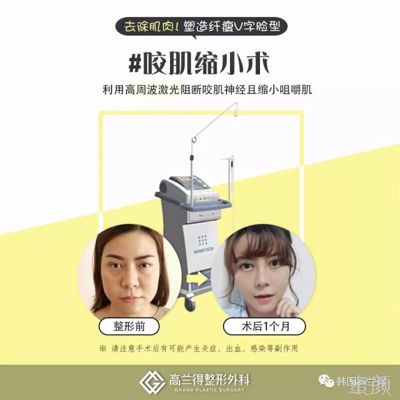 https://img.miyanlife.com/mnt/timg/180201/13295JX4-1.jpg