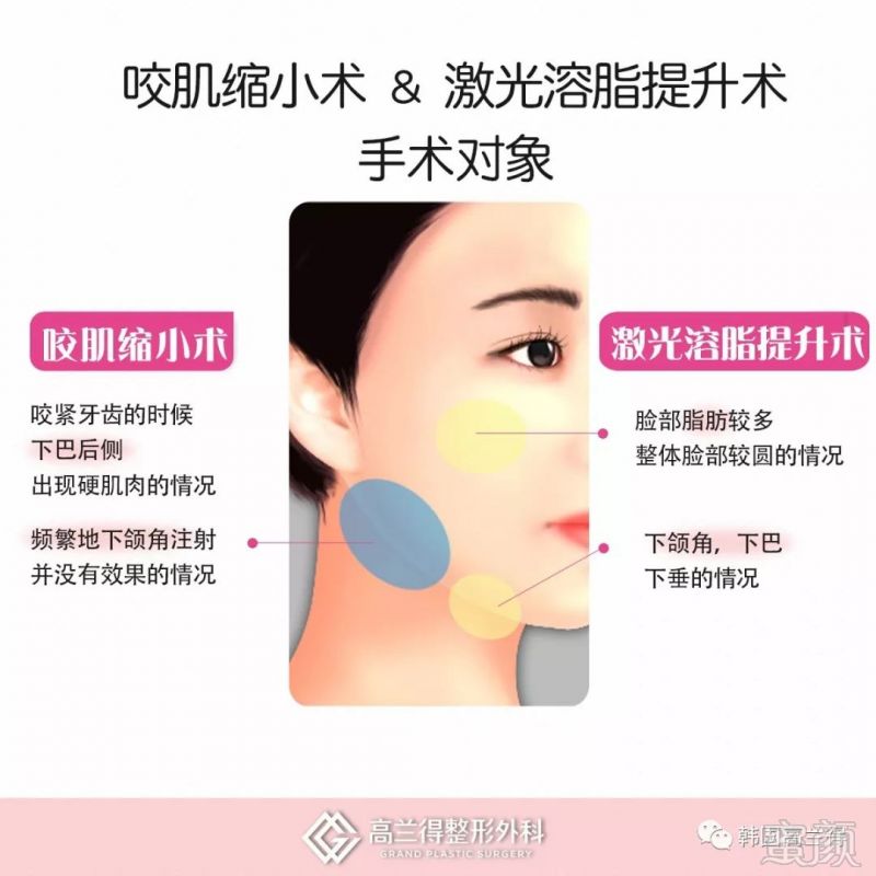 https://img.miyanlife.com/mnt/timg/180201/13295L531-0.jpg