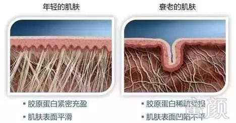 案例图片