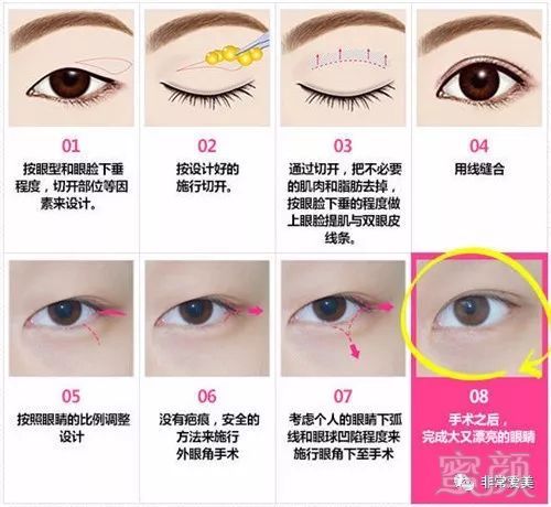 https://img.miyanlife.com/mnt/timg/180202/104R951O-6.jpg