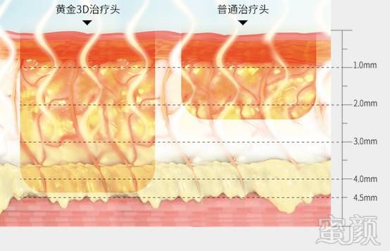 案例图片