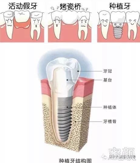 https://img.miyanlife.com/mnt/timg/180202/110I11D7-4.jpg