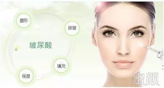 https://img.miyanlife.com/mnt/timg/180202/1120292193-15.jpg