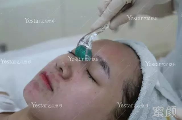 https://img.miyanlife.com/mnt/timg/180202/112Z4D57-6.jpg