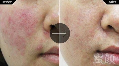 https://img.miyanlife.com/mnt/timg/180202/112Z644B-13.jpg