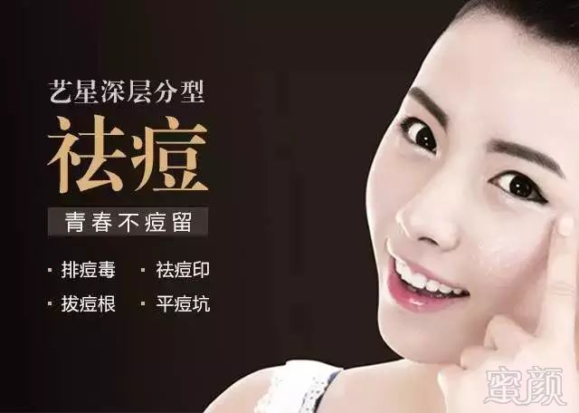 https://img.miyanlife.com/mnt/timg/180202/112ZBE3-11.jpg