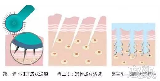 https://img.miyanlife.com/mnt/timg/180202/11325T538-4.jpg