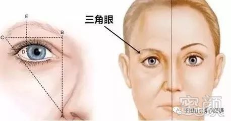 https://img.miyanlife.com/mnt/timg/180202/113F35F0-0.jpg