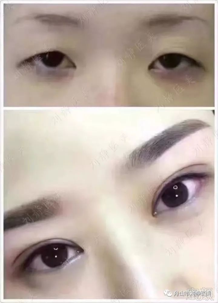 https://img.miyanlife.com/mnt/timg/180202/113F3F28-1.jpg
