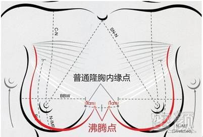 案例图片