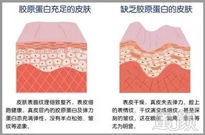 案例图片